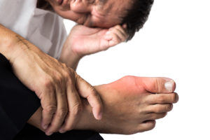 Man with Gout Med Pic